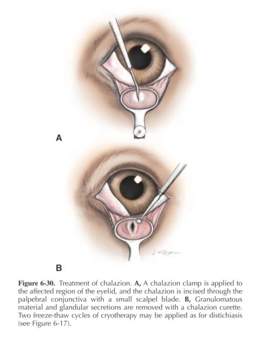 ophthalmologie_op_-chalizion_maggs_et_al._2008_.jpg ophthalmologie_op_-chalizion_maggs_et_al._2008_.jpg