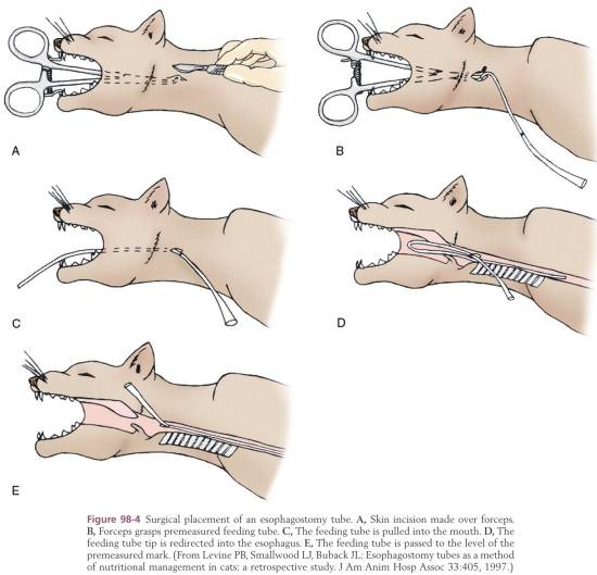 op_-_nasenschlund-sonde_tobias_2013_.jpg op_-_nasenschlund-sonde_tobias_2013_.jpg