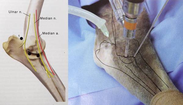 Arthroskopie Ellbogen (Beale et al., 2003) Arthroskopie Ellbogen (Beale et al., 2003)