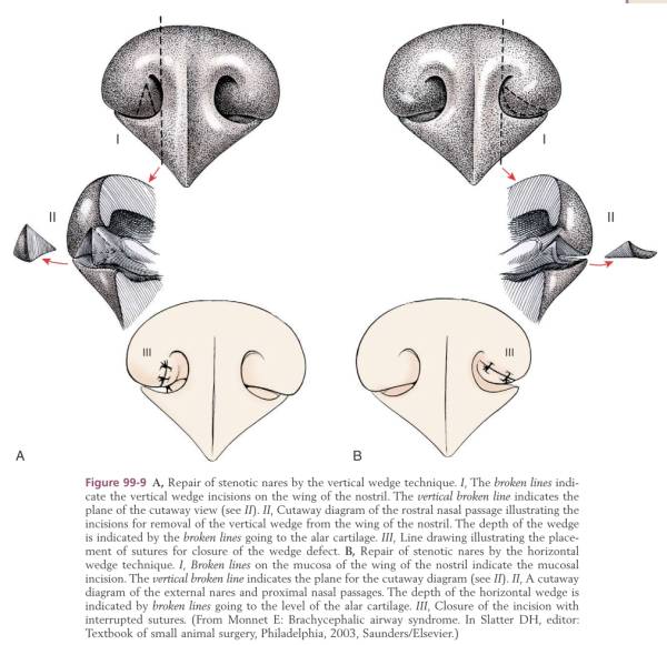 op_nasenloecher_erweitern_tobias_johnston_2012_.jpg op_nasenloecher_erweitern_tobias_johnston_2012_.jpg