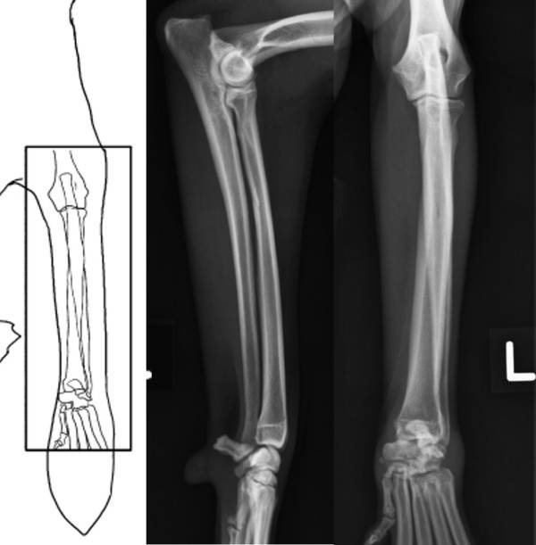 Röntgenlagerung Unterarm Röntgenlagerung Unterarm