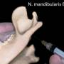 zahnmedizin_-_nervenblock_n._mandibularis_extraorbital_gorrel_2004_.jpg