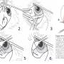 ophthalmologie_op_-_cherry_eye_morgan_pocket_technik_maggs_et_al._2008_.jpg