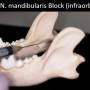 zahnmedizin_-_nervenblock_n._mandibularis_infraorbital_gorrel_2004_.jpg