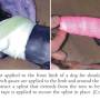orthopaedie_-_spica-splint_tobias_2012_.jpg