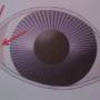 ophthalmologie-nasalekanthusplastikpauli_1.jpg