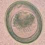 parasiten_toxascaris_leonina_quelle_unbekannt_.jpg