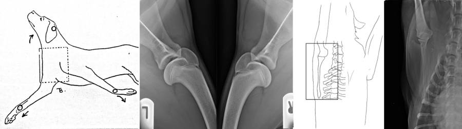 Röntgenlagerung Schulter Röntgenlagerung Schulter