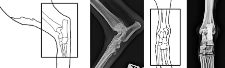 Röntgenlagerung Tarsus Röntgenlagerung Tarsus