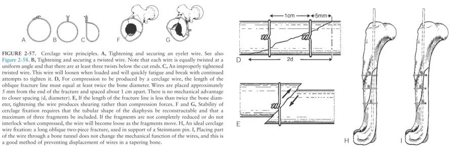 op_-_cerclagen_grundlagen_decamp_2016_.jpg op_-_cerclagen_grundlagen_decamp_2016_.jpg