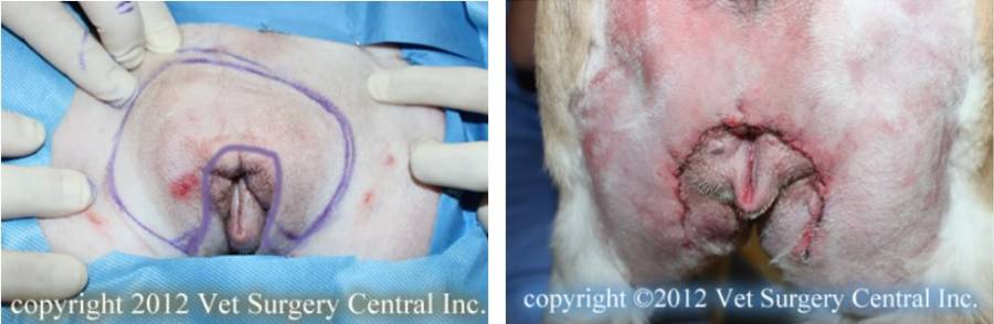 Episioplastik Episioplastik