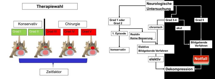 Vorgehen BSV (Forterre, 2021) Vorgehen BSV (Forterre, 2021)