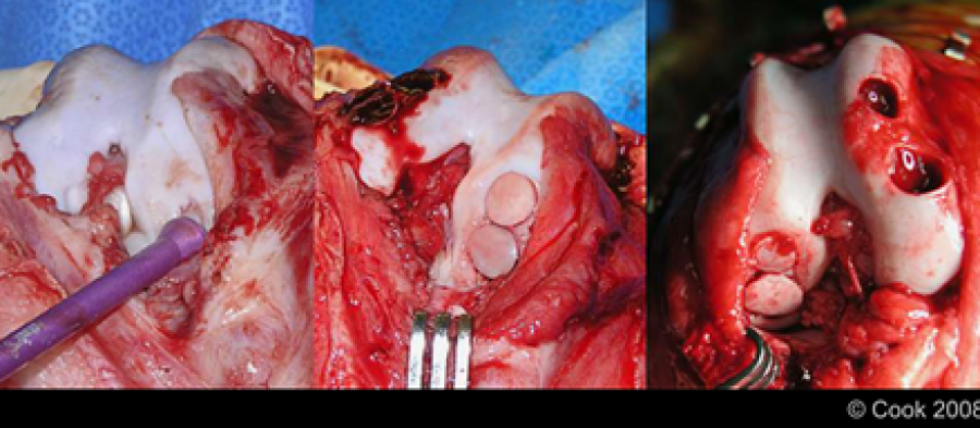 Osteochondraler Autograft (Cook, 2008) Osteochondraler Autograft (Cook, 2008)