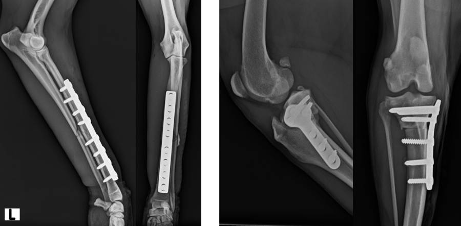 Röntgenlagerung post OP mit Implantaten Röntgenlagerung post OP mit Implantaten
