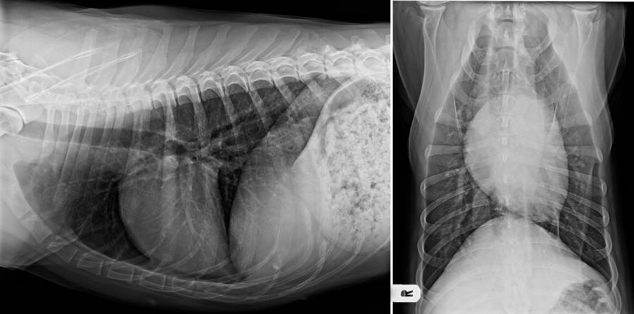 Röntgenlagerung Thorax Röntgenlagerung Thorax