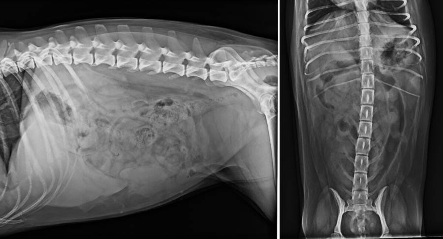 Röntgenlagerung Abdomen Röntgenlagerung Abdomen