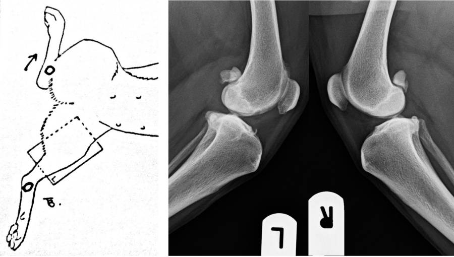 Röntgenlagerung Knie Röntgenlagerung Knie
