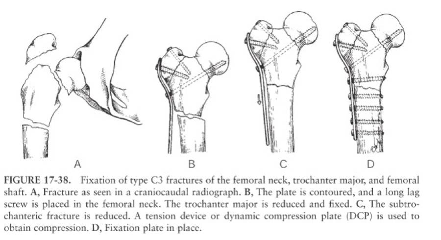 op_-_femurfraktur_-_komplexe_proximale_femurfraktur_piermattei_2017_.jpg op_-_femurfraktur_-_komplexe_proximale_femurfraktur_piermattei_2017_.jpg