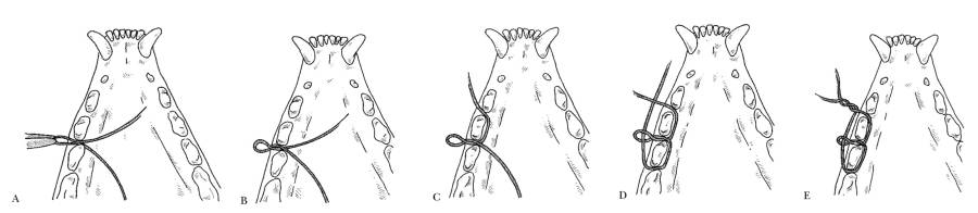 op_-_interdental_wiring_3_holmstrom_2007_.jpg op_-_interdental_wiring_3_holmstrom_2007_.jpg