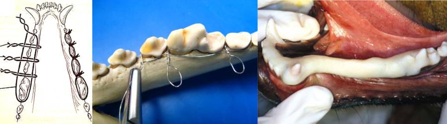 op_-_interdental_wiring_0_holmstrom_2007_.jpg op_-_interdental_wiring_0_holmstrom_2007_.jpg