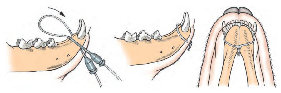 op_-_unterkiefer-symphysenfraktur_fossum_2013_.jpg op_-_unterkiefer-symphysenfraktur_fossum_2013_.jpg