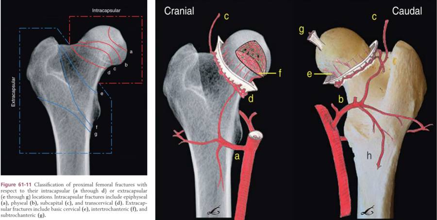 op_-_femurfraktur_-_proximale_femurfraktur_blutversorgung_tobias_2012_.jpg op_-_femurfraktur_-_proximale_femurfraktur_blutversorgung_tobias_2012_.jpg