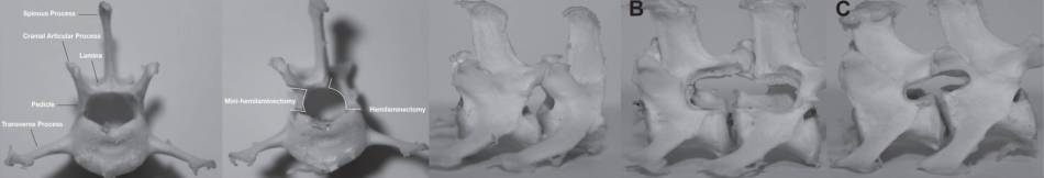 neurochirurgie_-_hemilaminektomie_vs._minihemilaminektomie.jpg neurochirurgie_-_hemilaminektomie_vs._minihemilaminektomie.jpg