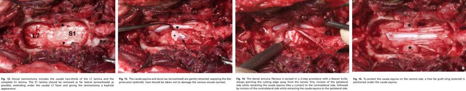 neurochirurgie_-_dorsale_laminektomie_ces_2_meij_bergknut_2010_.jpg neurochirurgie_-_dorsale_laminektomie_ces_2_meij_bergknut_2010_.jpg