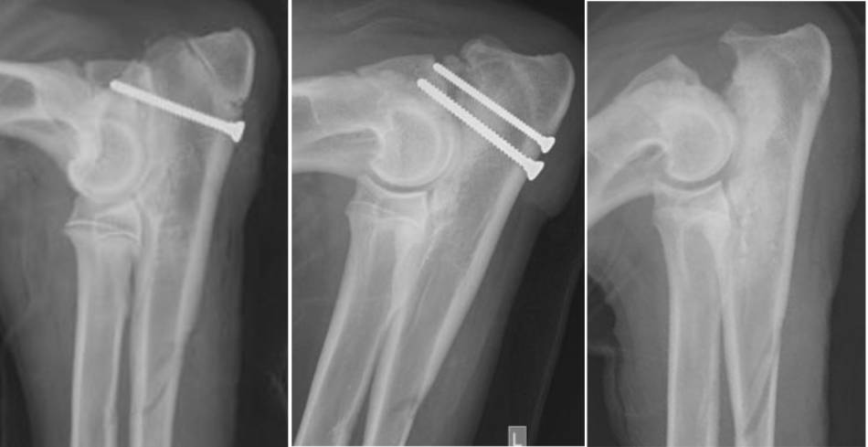 op_-_ipa_zugschraube.jpg op_-_ipa_zugschraube.jpg