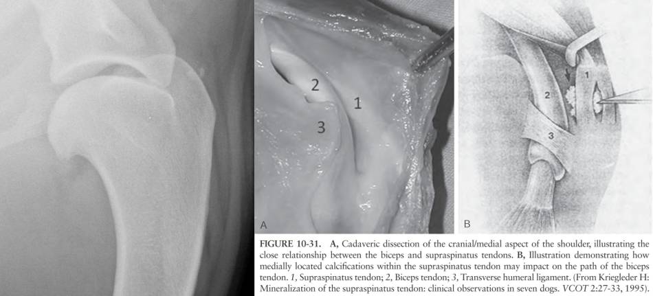 orthopaedie_-_resektion_verkalkung_m._supraspinatus_riegler_m_2018_vcot_1995_.jpg orthopaedie_-_resektion_verkalkung_m._supraspinatus_riegler_m_2018_vcot_1995_.jpg