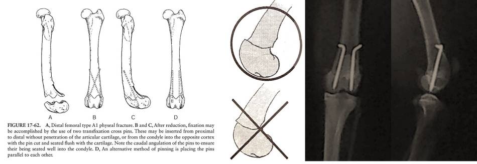 op_-_femurfraktur_-_distale_epiphysiolyse_femur_piermattei_2017_.jpg op_-_femurfraktur_-_distale_epiphysiolyse_femur_piermattei_2017_.jpg