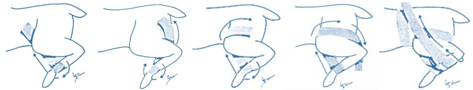 orthopaedie_-_verband_ehmer-schlinge_bojrab_2014_.jpg orthopaedie_-_verband_ehmer-schlinge_bojrab_2014_.jpg