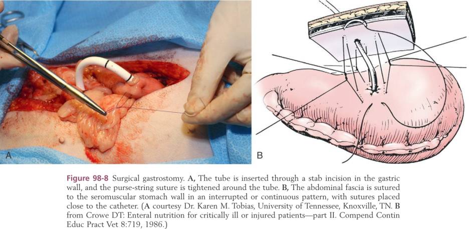 op_-_gastrotomie-sonde_tobias_2012_.jpg op_-_gastrotomie-sonde_tobias_2012_.jpg