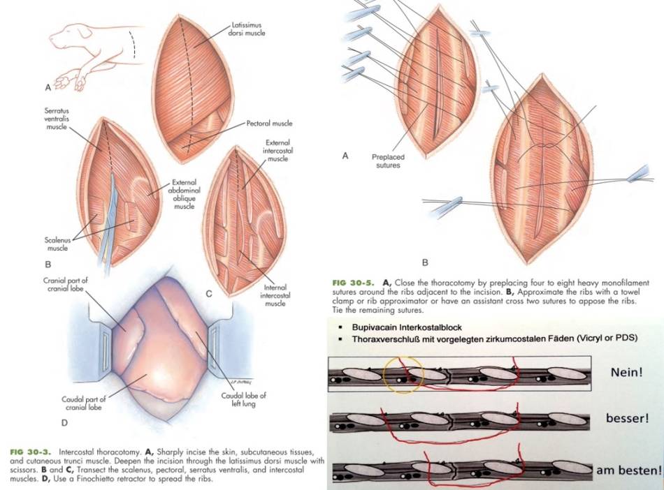 op_-_thorakotomie_tobias_johnston_2012_tk_hofheim_.jpg op_-_thorakotomie_tobias_johnston_2012_tk_hofheim_.jpg